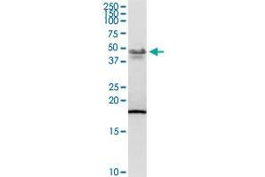 PCYT1B MaxPab rabbit polyclonal antibody. (PCYT1B antibody  (AA 1-369))
