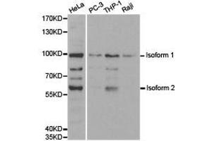 Western Blotting (WB) image for anti-Ubiquitin-Like with PHD and Ring Finger Domains 2, E3 Ubiquitin Protein Ligase (UHRF2) antibody (ABIN1875279) (UHRF2 antibody)