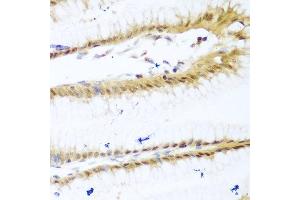Immunohistochemistry of paraffin-embedded human stomach using UNG antibody at dilution of 1:100 (40x lens).
