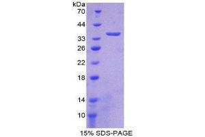 SDS-PAGE (SDS) image for 5'-Nucleotidase, Cytosolic III (NT5C3) (AA 52-336) protein (His tag) (ABIN1981152)
