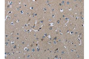 The image on the left is immunohistochemistry of paraffin-embedded Human brain tissue using ABIN7129423(FAAH Antibody) at dilution 1/50, on the right is treated with fusion protein. (FAAH antibody)