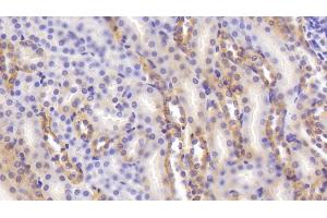 Detection of CASR in Mouse Kidney Tissue using Polyclonal Antibody to Calcium Sensing Receptor (CASR) (CASR antibody  (AA 863-1079))