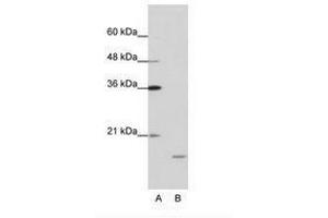 Image no. 1 for anti-Interferon Stimulated Exonuclease Gene 20kDa (ISG20) (AA 35-84) antibody (ABIN202043)