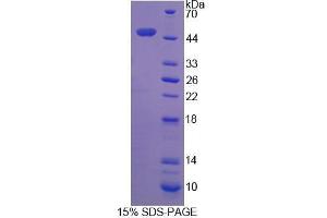 Image no. 1 for Dynactin 2 (p50) (DCTN2) (AA 2-401) protein (His tag) (ABIN6239617)
