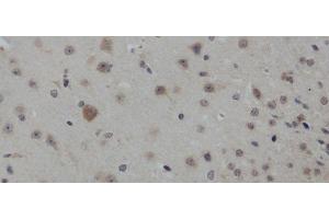Immunohistochemistry of paraffin-embedded Mouse brain using IL4 Polyclonal Antibody at dilution of 1:50 (IL-4 antibody)