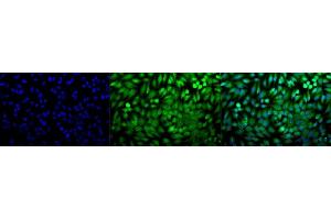 Immunocytochemistry/Immunofluorescence analysis using Rabbit Anti-p38 Polyclonal Antibody (ABIN361847 and ABIN361848). (MAPK14 antibody)