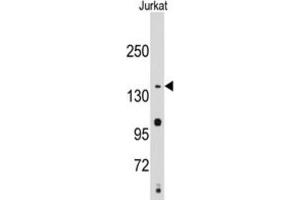 Western Blotting (WB) image for anti-Structural Maintenance of Chromosomes 2 (SMC2) antibody (ABIN2995231) (SMC2 antibody)