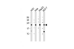 All lanes : Anti-LITAF Antibody (N-Term) at 1:1000 dilution Lane 1: A431 whole cell lysate Lane 2: Hela whole cell lysate Lane 3: HepG2 whole cell lysate Lane 4: MCF-7 whole cell lysate Lysates/proteins at 20 μg per lane. (LITAF antibody  (AA 31-60))