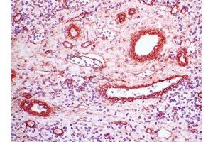 Image no. 1 for anti-Collagen, Type IV (COL4) antibody (ABIN481663) (Collagen IV antibody)