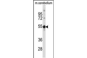 Western blot analysis in mouse cerebellum tissue lysates (35ug/lane). (TSPYL5 antibody  (C-Term))