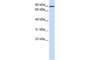WB Suggested Anti-ATMIN Antibody Titration:  0. (ATM Interactor antibody  (Middle Region))