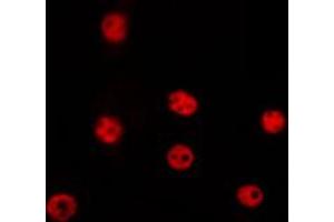 ABIN6268956 staining Hela by IF/ICC. (Cyclin D2 antibody  (C-Term))