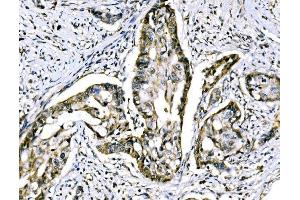 IHC analysis of RRS1 using anti-RRS1 antibody (ABIN7601344). (RRS1 antibody  (AA 33-266))