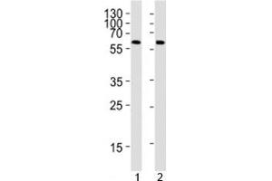 Western Blotting (WB) image for anti-Peroxisome Proliferator-Activated Receptor gamma (PPARG) (N-Term) antibody (ABIN3032196)