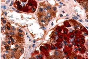 Anti-GHRHR antibody  ABIN1048653 IHC staining of human pituitary, anterior. (GHRHR antibody  (Cytoplasmic Domain))