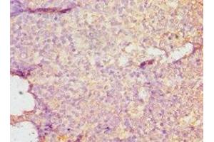 Immunohistochemistry of paraffin-embedded human tonsil tissue using ABIN7149695 at dilution of 1:100 (DMP1 antibody  (AA 254-513))