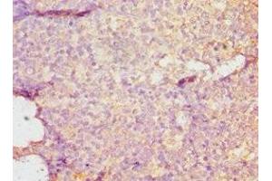 Immunohistochemistry of paraffin-embedded human tonsil tissue using ABIN7149695 at dilution of 1:100 (DMP1 antibody  (AA 254-513))