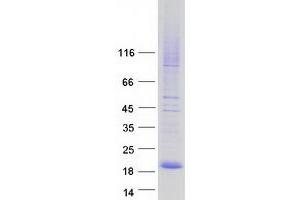 Validation with Western Blot