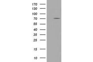 Western Blotting (WB) image for anti-Tripartite Motif Containing 2 (TRIM2) (AA 1-100), (AA 645-744) antibody (ABIN1490544) (TRIM2 antibody  (AA 1-100, AA 645-744))