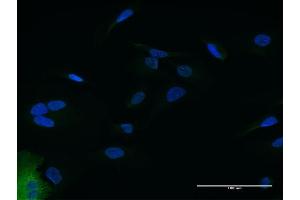 Immunofluorescence of purified MaxPab antibody to IFIT2 on HeLa cell. (IFIT2 antibody  (AA 1-484))