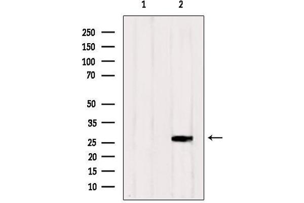 RAB33A antibody  (Internal Region)