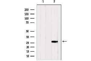 Western blot analysis of extracts from HepG2, using RAB33A Antibody. (RAB33A antibody  (Internal Region))