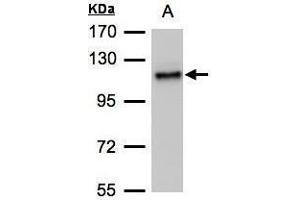 ADAMTSL2 抗体  (C-Term)