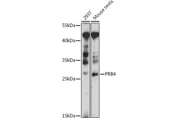 PRB4 抗体  (AA 178-247)