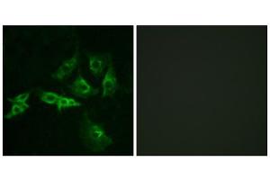Immunofluorescence analysis of A549 cells, using GNRHR antibody. (GNRHR antibody  (Internal Region))