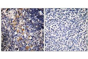 Immunohistochemistry analysis of paraffin-embedded human thymus gland tissue using MCPH1 antibody. (MCPH1 antibody  (N-Term))