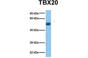 Host:  Rabbit  Target Name:  TBX20  Sample Tissue:  Human Lung Tumor  Antibody Dilution:  1. (TBX20 antibody  (Middle Region))