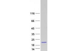 Western Blotting (WB) image for SH2 Domain Containing 1B (SH2D1B) protein (Myc-DYKDDDDK Tag) (ABIN2731955)
