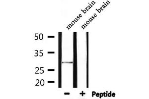 Western blot analysis of extracts from mouse brain, using SENP8 Antibody.