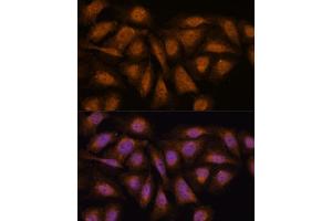 Immunofluorescence analysis of U-2 OS cells using PP2A-B56δ/PR61δ/PP2A-B56δ/PR61δ/PPP2R5D antibody (ABIN7269690) at dilution of 1:100. (PPP2R5D antibody  (AA 450-550))