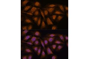 Immunofluorescence analysis of U-2 OS cells using PP2A-B56δ/PR61δ/PP2A-B56δ/PR61δ/PPP2R5D antibody (ABIN7269690) at dilution of 1:100. (PPP2R5D antibody  (AA 450-550))