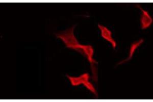 ABIN6274127 staining HeLa by IF/ICC. (BCAR3 antibody  (C-Term))