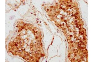 IHC image of ABIN7158634 diluted at 1:400 and staining in paraffin-embedded human testis tissue performed on a Leica BondTM system. (Ly6k antibody  (AA 18-138))