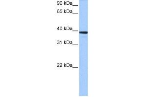 WB Suggested Anti-MRM1 Antibody Titration:  0. (MRM1 antibody  (C-Term))