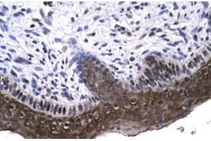 Human Spermatophore (RAX antibody  (N-Term))