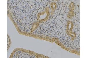 ABIN6279103 at 1/100 staining Human uterus tissue by IHC-P.