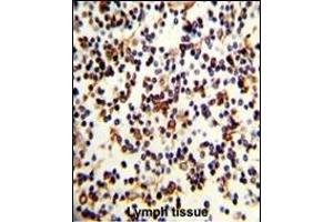 Formalin-fixed and paraffin-embedded human Lymph reacted with CR2 Antibody (C-term), which was peroxidase-conjugated to the secondary antibody, followed by DAB staining. (CD21 antibody  (C-Term))