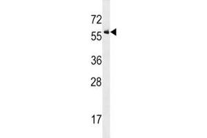 ALK2 antibody western blot analysis in U937 lysate (ACVR1 antibody  (AA 132-162))