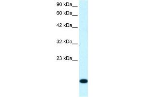 WB Suggested Anti-RPS16 Antibody Titration:  1. (RPS16 antibody  (N-Term))