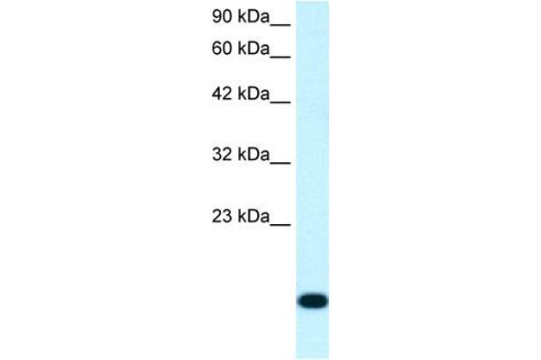 RPS16 Antikörper  (N-Term)
