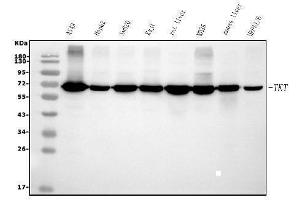 Western blot analysis of Transketolase/TKT using anti-Transketolase/TKT antibody (ABIN7598958). (TKT antibody  (AA 1-116))