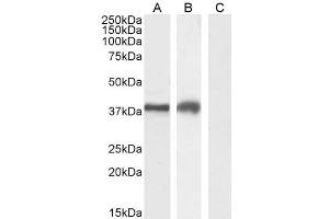 TIM3 antibody  (Internal Region)