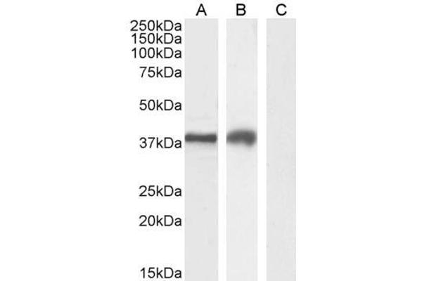 TIM3 antibody  (Internal Region)