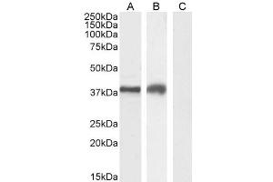 ABIN185571 (2µg/ml) staining of Jurkat (A), MOLT4 (B) and negative control A431 (C) cell lysate (35µg protein in RIPA buffer).