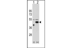 Western blot analysis of ETNK2 (arrow) using ETNK2 Antibody (N-term) Cat. (Ethanolamine Kinase 2 antibody  (N-Term))