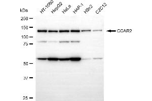 anti-Cell Cycle and Apoptosis Regulator 2 (CCAR2) antibody